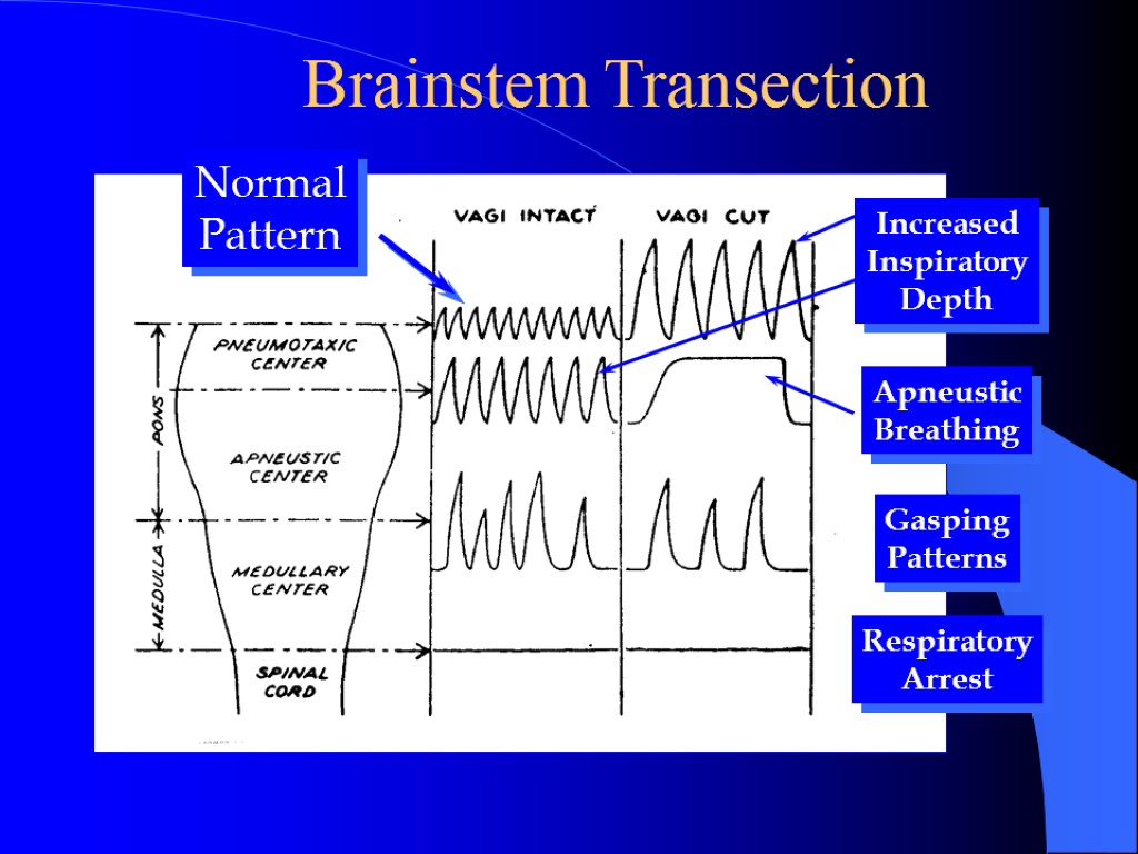 Brainstem Transection